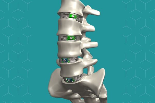 NovApproach Spine Launches OneLIF™ Interbody Fusion Device at North ...