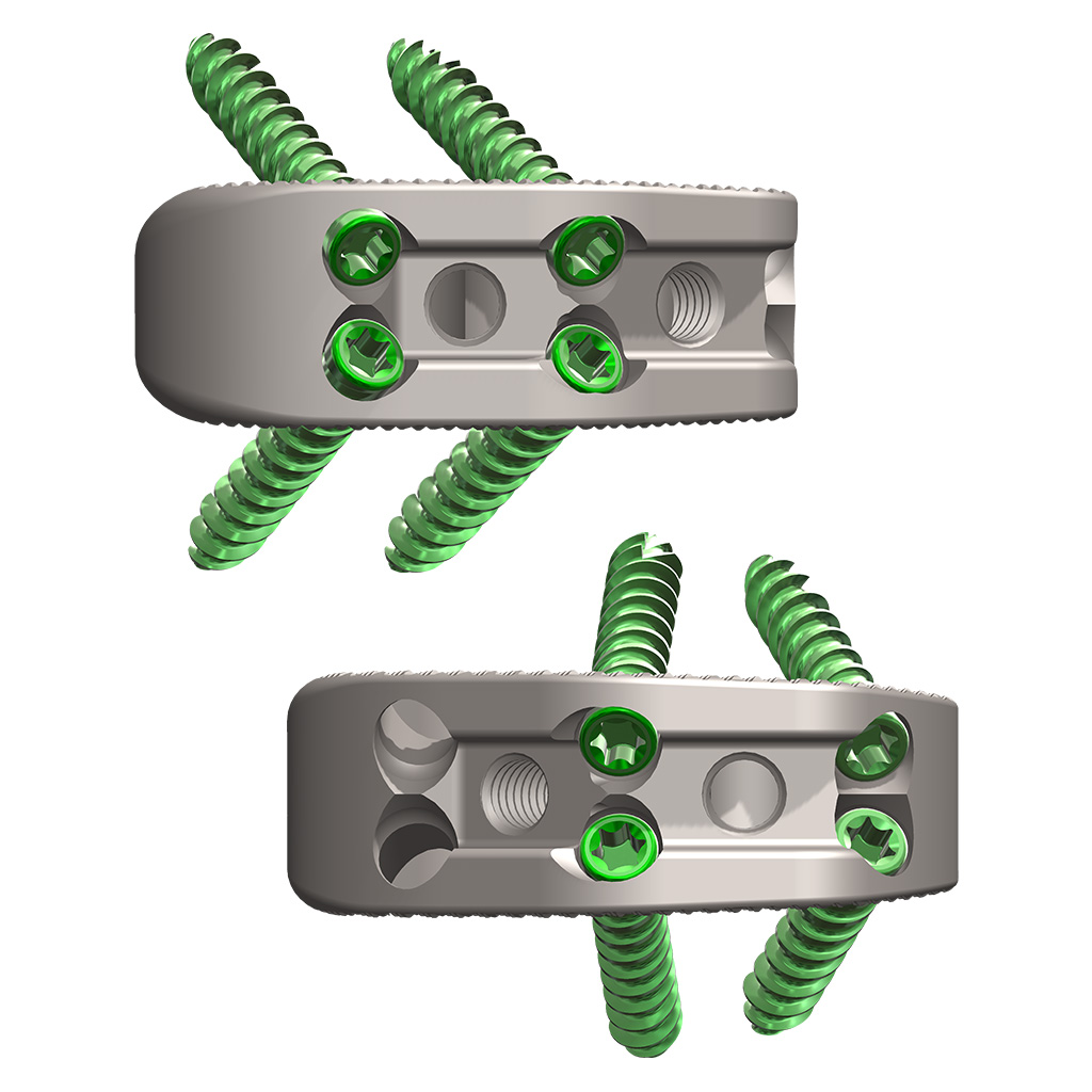 Novapproach Spine OneLIF Implants with Screws