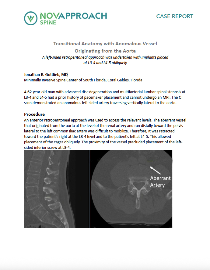 Navigating aberrant vessel through oblique approach in an ASC setting